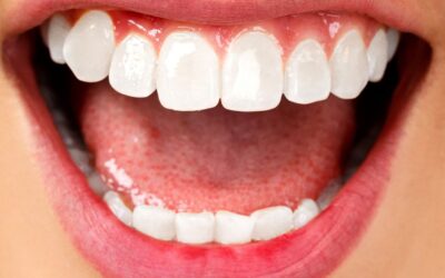 De gezondheid van onze tanden